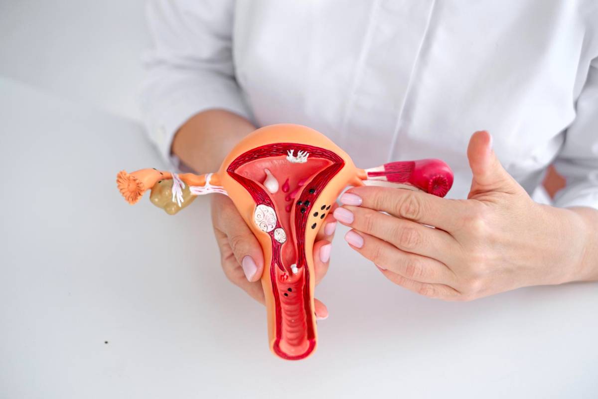 Como-se-diagnostica-la-endometriosis