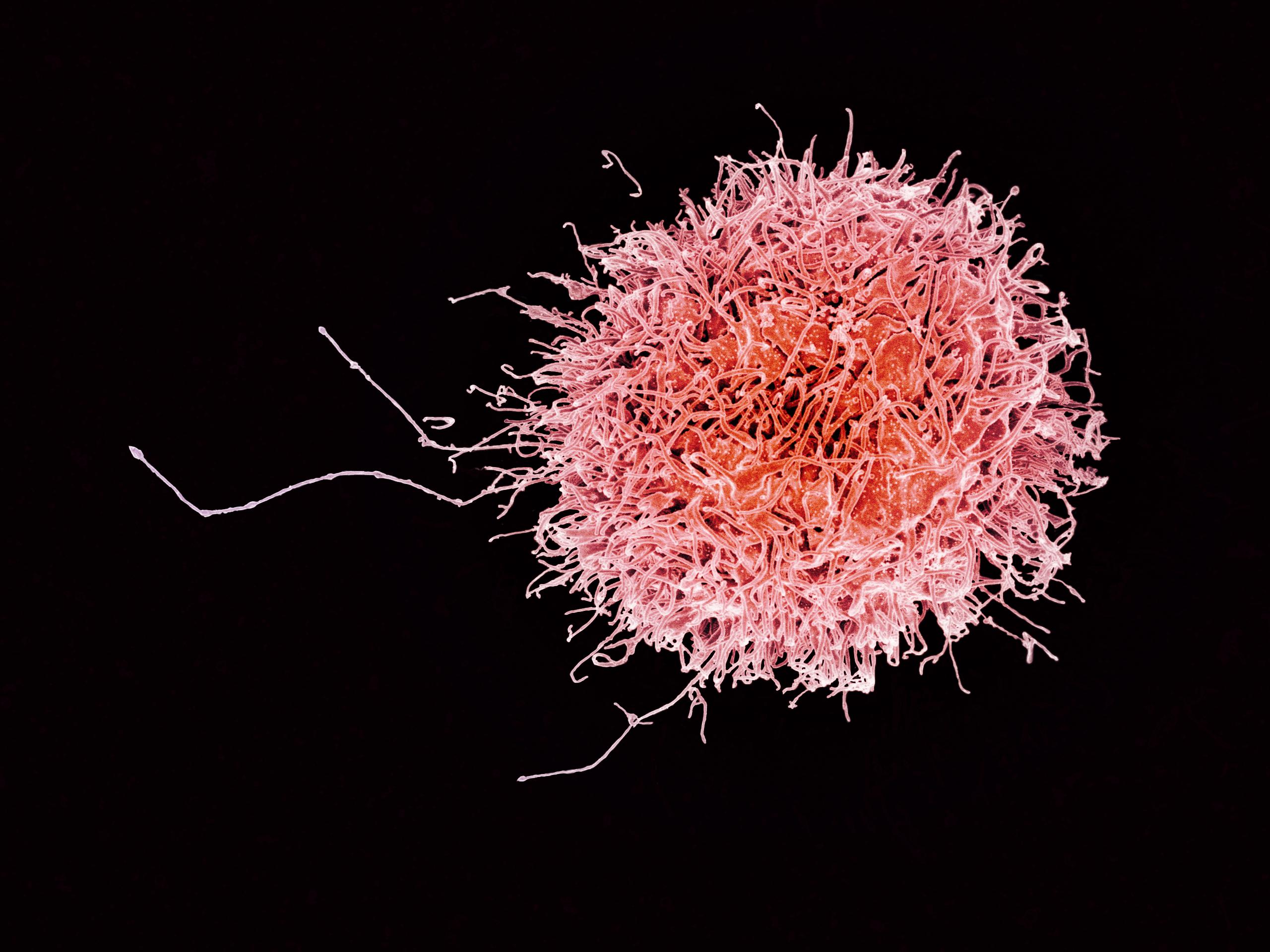 Human_Natural_Killer_Cell_(29228845335)